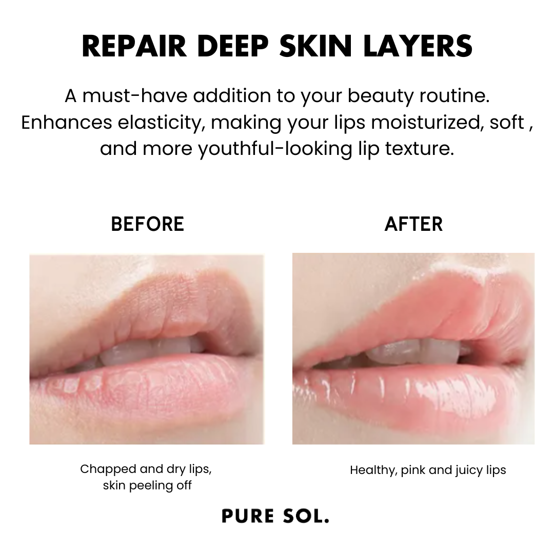 Hydrogel Collagen Lip Mask for all types